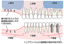 \Pbgtg@